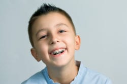 Early Orthodontic Treatment In Silver Spring Md Laurel Md