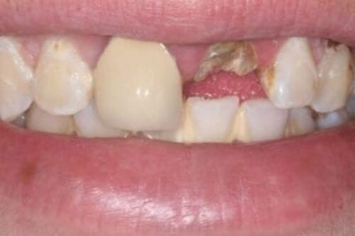 before and after pictures