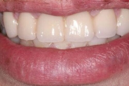 before and after pictures