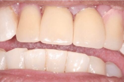 before and after pictures