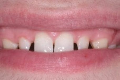 before and after pictures