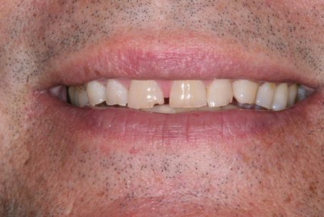 before and after pictures
