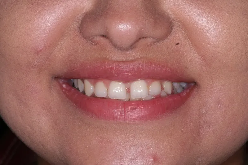 Before photo