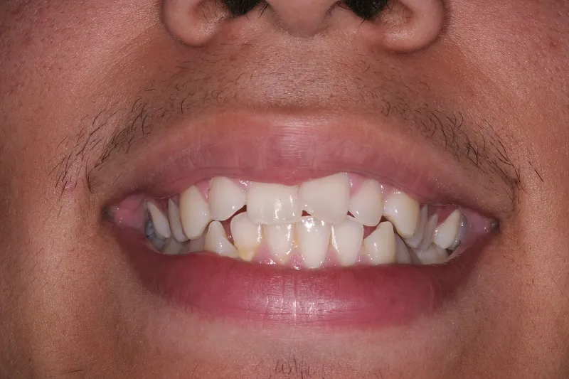 Before photo
